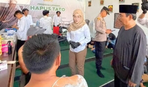 BAZNAS Jabar Luncurkan Program Jejak Baru, Layanan Hapus Tato Gratis untuk Buka Peluang Hidup dan Kerja yang Lebih Baik -0307 26- (3u)
